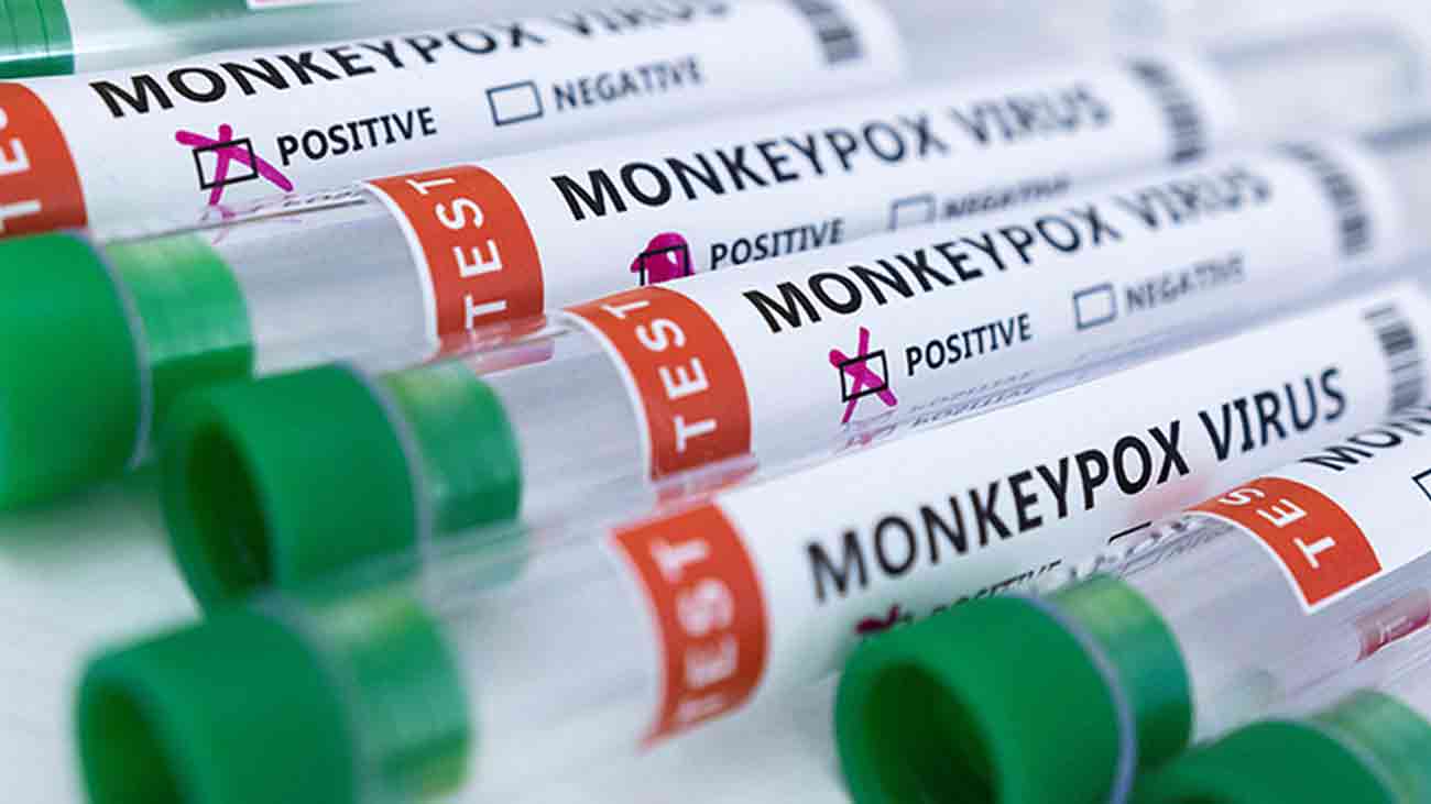 Medical Test Tubes for Taking Samples of Monkey Pox.