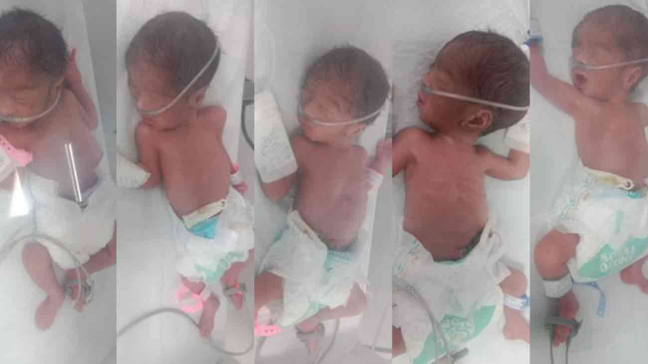 کراچی: خاتون کے ہاں بیک وقت پانچ بچوں کی پیدائش Karachi quintuplets birth