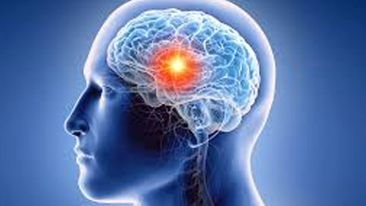  دماغی رسولی کی فوری تشخیص کا انقلابی طریقہ