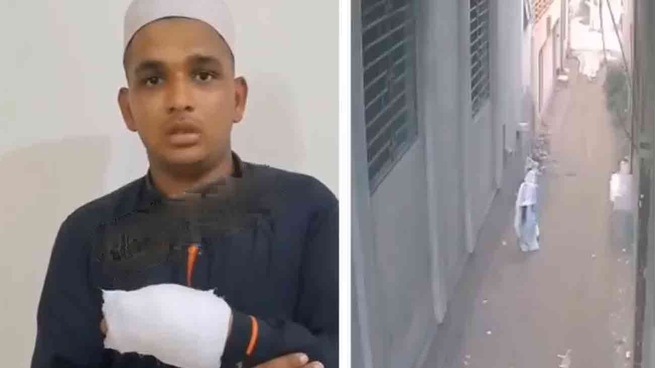 ٹوبہ ٹیک سنگھ میں خاتون کو ہراساں کرنے والا ملزم گرفتاری کے دوران موٹر سائیکل سے گر کر انگلیاں تڑوا بیٹھا